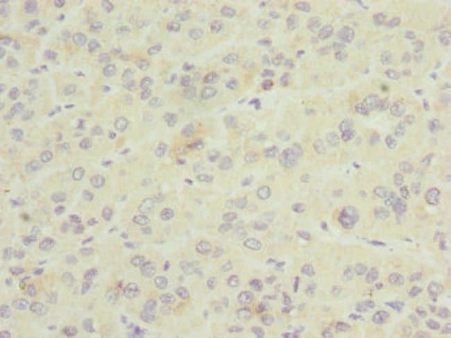 100UL GDAP1 ANTIBODY 100 ul