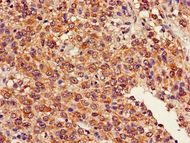 100UG GDAP1L1 ANTIBODY 100 ug