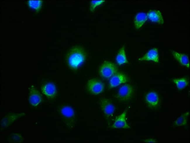 100UL GDF5 ANTIBODY 100 ul