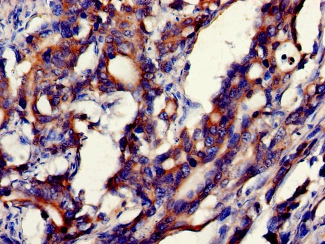 100UG GDI2 ANTIBODY 100 ug