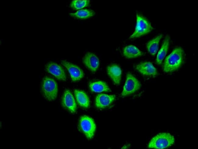 100UG GFR ALPHA-1 ANTIBODY 100 ug