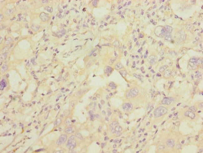 100UG GGTLC2 ANTIBODY 100 ug
