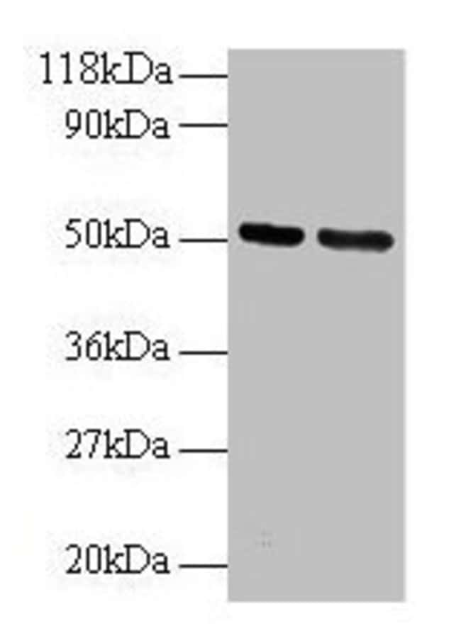 100UG GDI2 ANTIBODY 100 ug