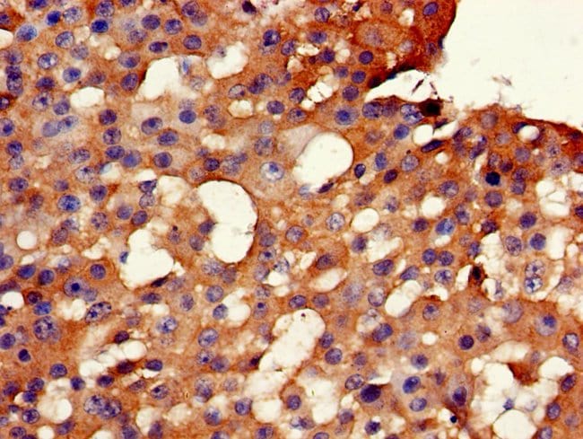 100UG GLYCEROL KINASE 2 ANTIBODY 100 ug