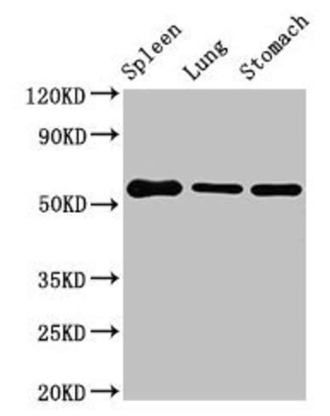 100UG GLP1R ANTIBODY 100 ug