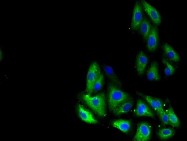 100UG GLP1R ANTIBODY 100 ug