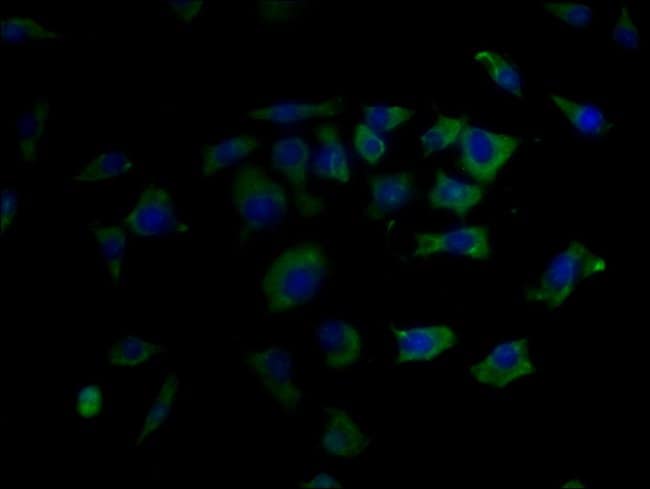 100UG GLP1R ANTIBODY 100 ug