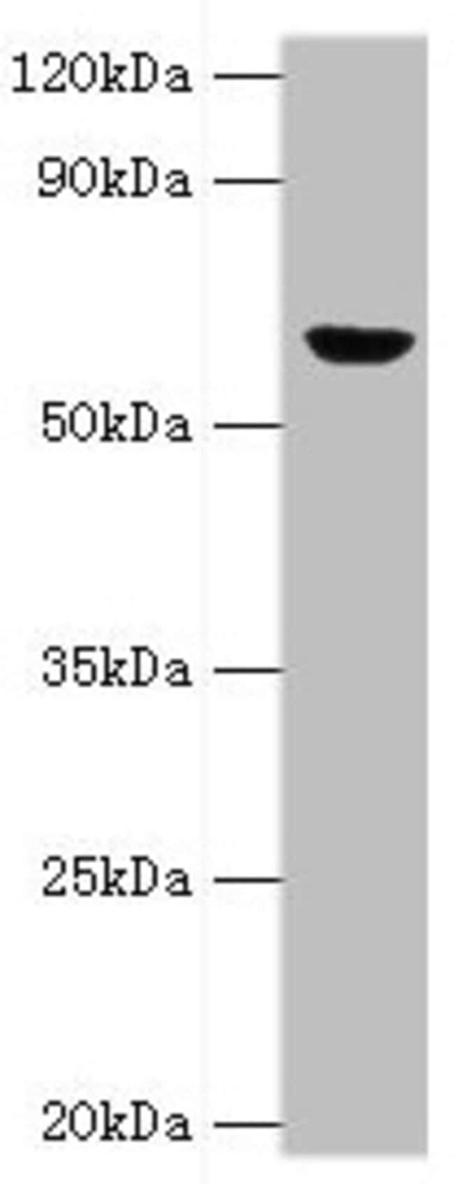 100UL GLUD2 ANTIBODY 100 ul