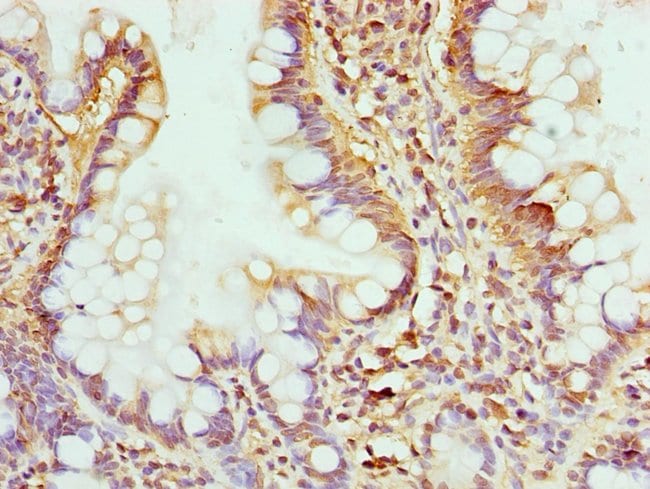 100UL GMPS ANTIBODY 100 ul