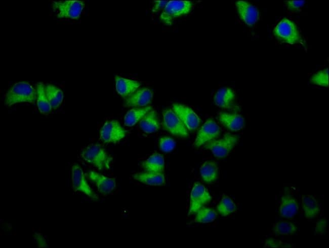 100UG GNA12 ANTIBODY 100 ug