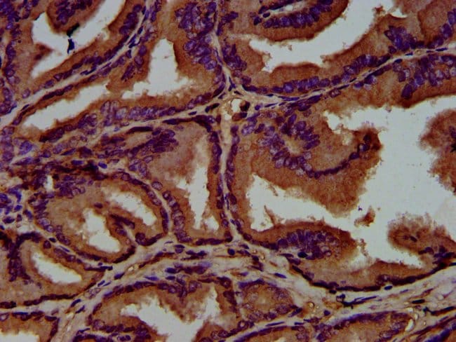 100UG GNAL ANTIBODY 100 ug