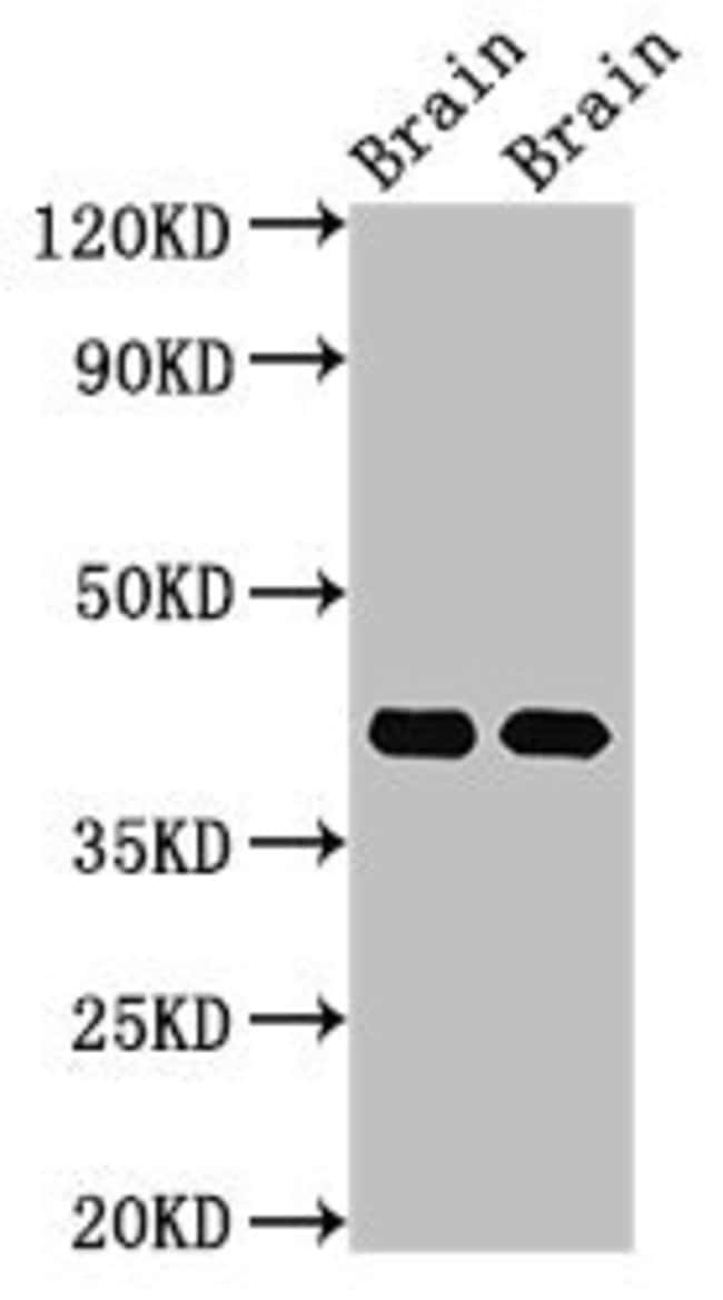100UG GNAO1 ANTIBODY 100 ug