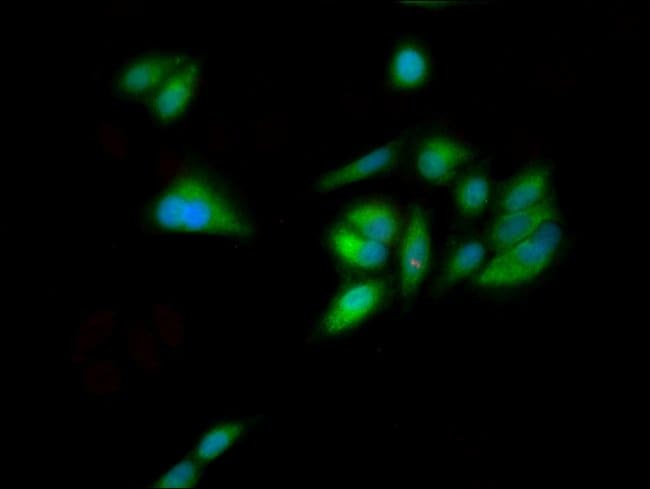 100UG GNL1 ANTIBODY 100 ug