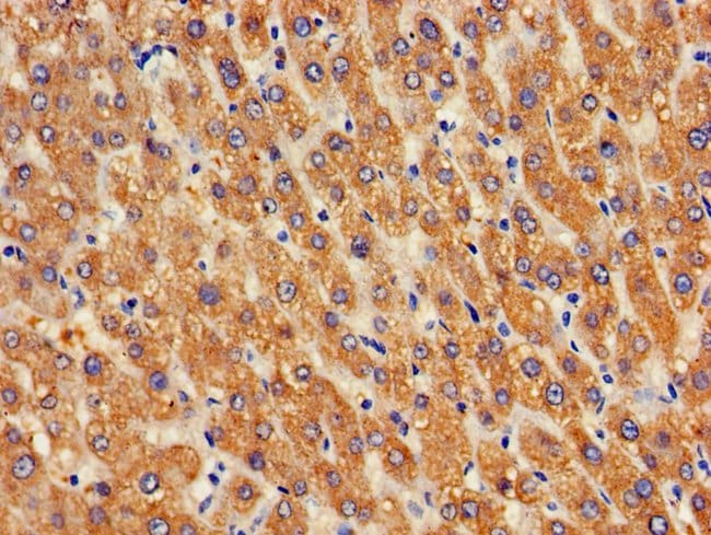 100UG GOSR2 ANTIBODY 100 ug