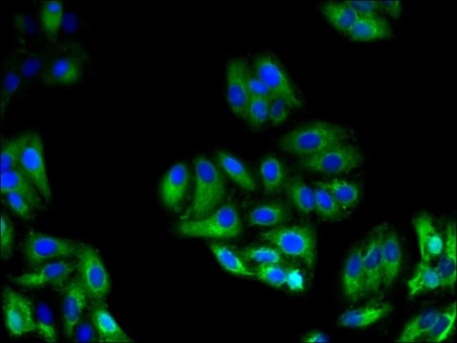 100UG GLYPICAN 4 ANTIBODY 100 ug
