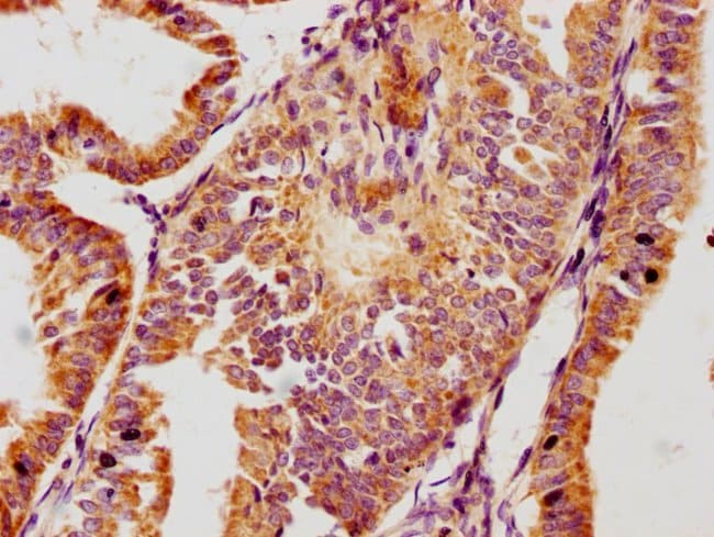 100UL GPLD1 ANTIBODY 100 ul