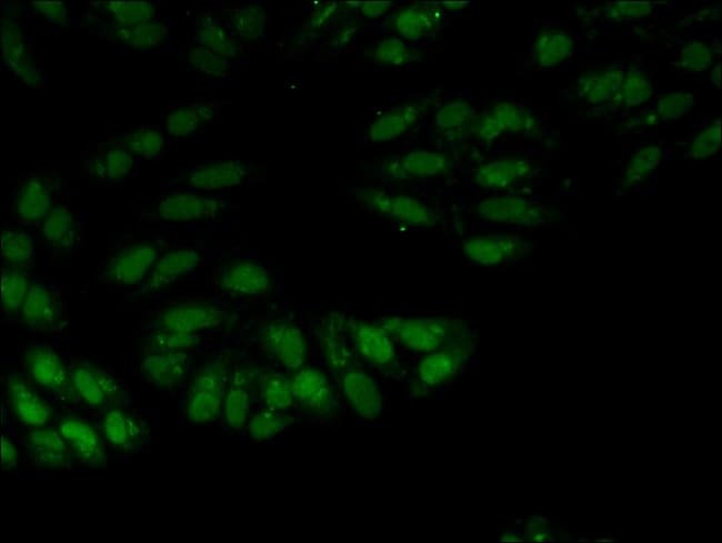 100UG SNRPA ANTIBODY 100 ug