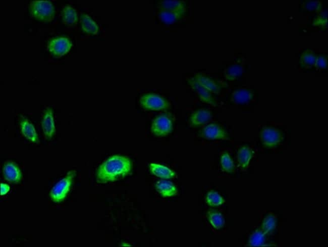 100UG GPR75 ANTIBODY 100 ug