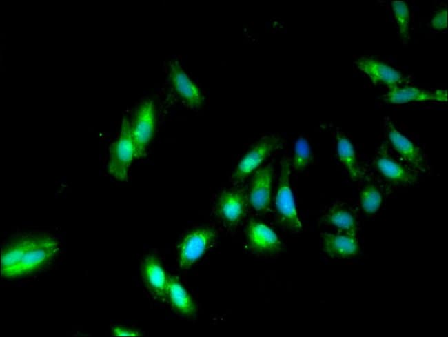 100UG PP2A BETA ANTIBODY 100 ug