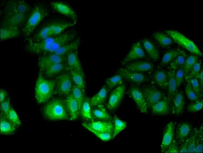 100UG GPT ANTIBODY 100 ug