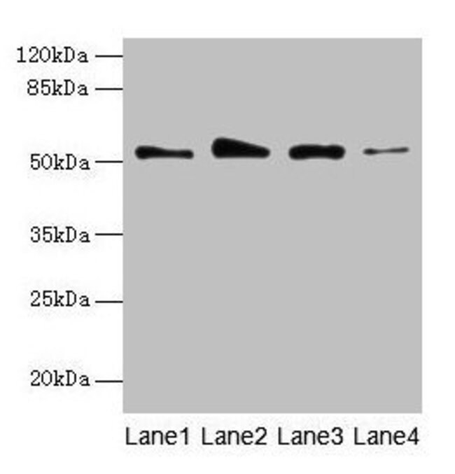 100UG GSDMD ANTIBODY 100 ug