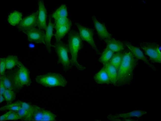 100UG GELSOLIN ANTIBODY 100 ug
