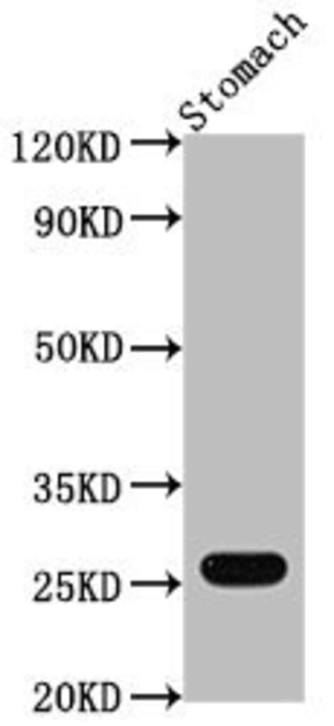 100UL GSTA1 ANTIBODY 100 ul