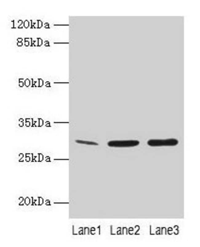 100UG GTF2F2 ANTIBODY 100 ug