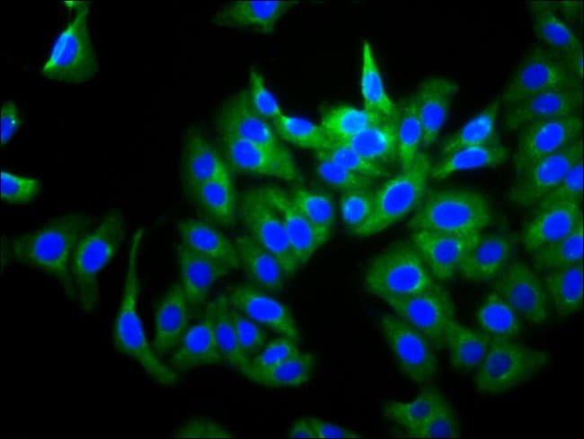 100UG PGCD ANTIBODY 100 ug