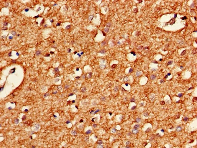 100UG HARS2 ANTIBODY 100 ug