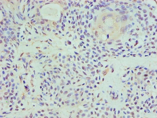 100UL HAT1 ANTIBODY 100 ul