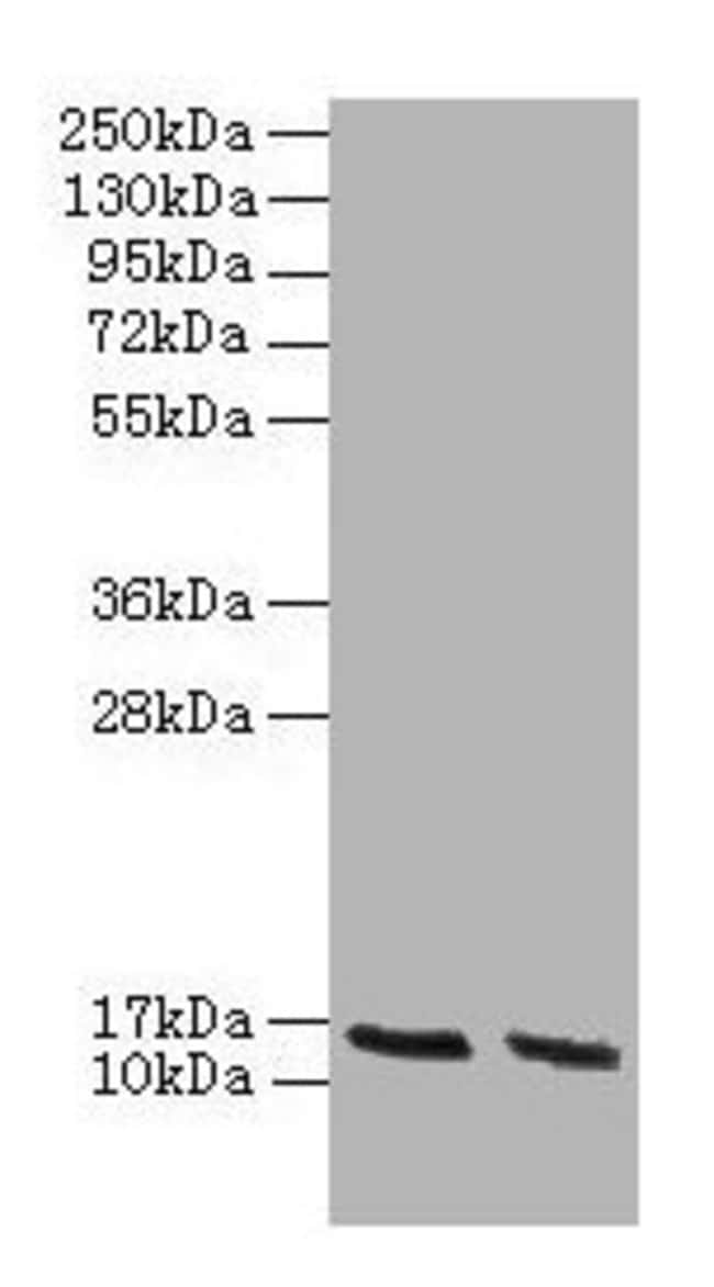 100UG HBA2 ANTIBODY 100 ug
