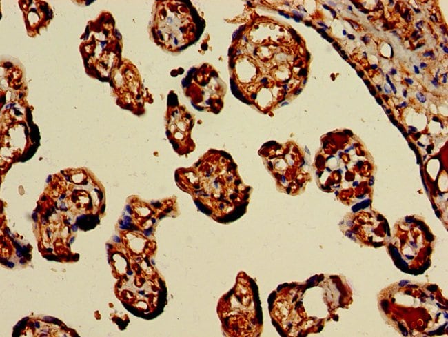 100UG HBB ANTIBODY 100 ug