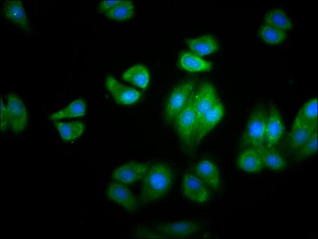 100UG HBG2 ANTIBODY 100 ug