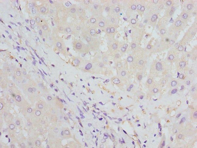 100UL HBZ ANTIBODY 100 ul