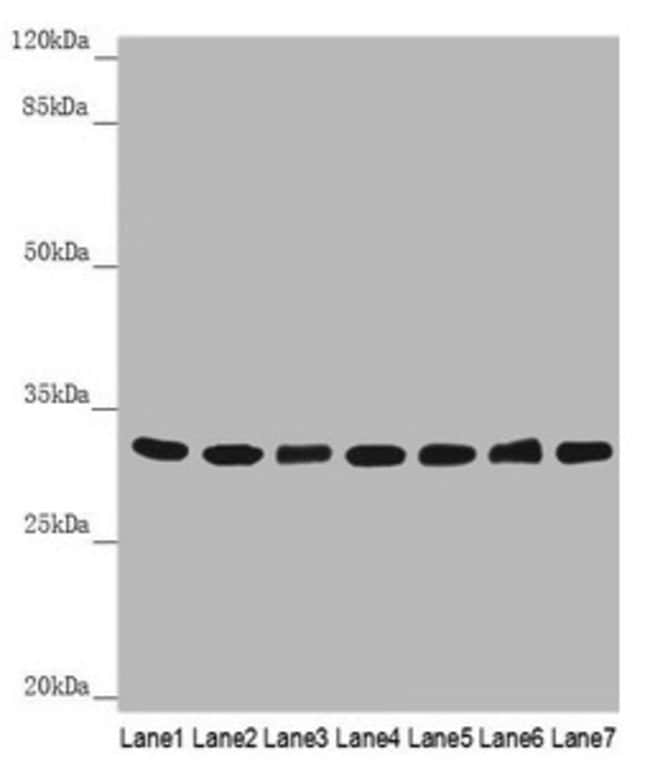100UL HCCS ANTIBODY 100 ul