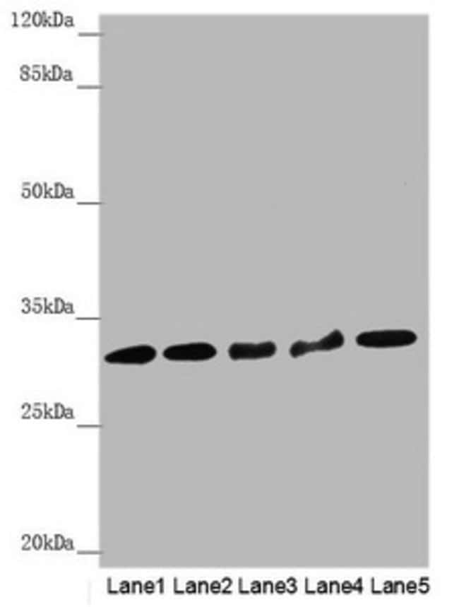 100UL HCCS ANTIBODY 100 ul