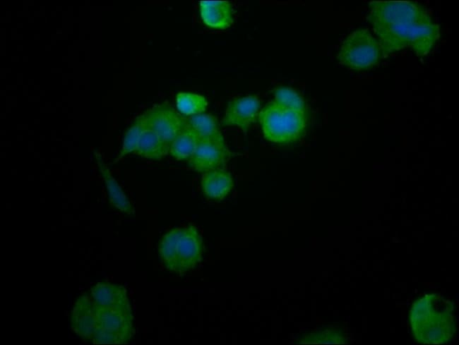 100UG HEPACAM ANTIBODY 100 ug