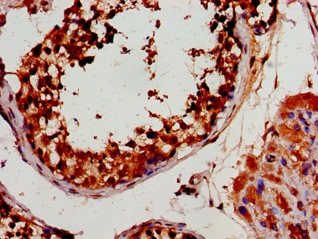 100UG HEXIM2 ANTIBODY 100 ug