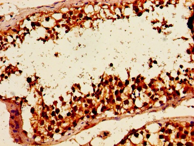 100UG HLTF ANTIBODY 100 ug