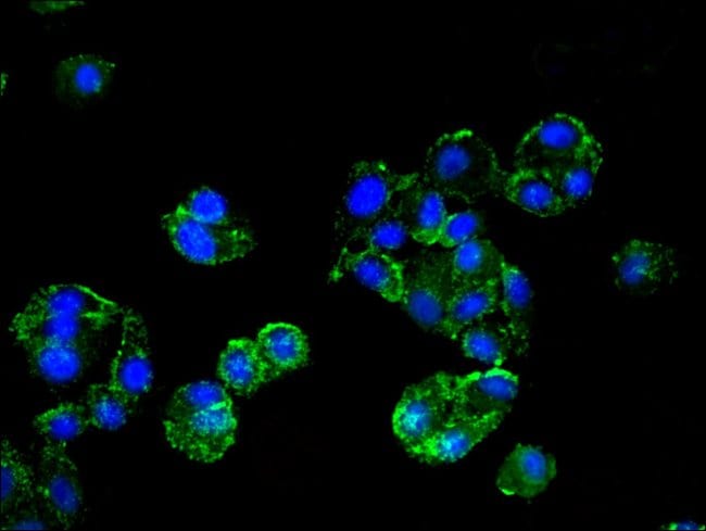 100UG HMBS ANTIBODY 100 ug