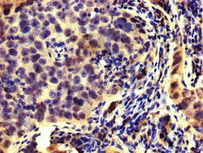 100UG HMGCR ANTIBODY 100 ug