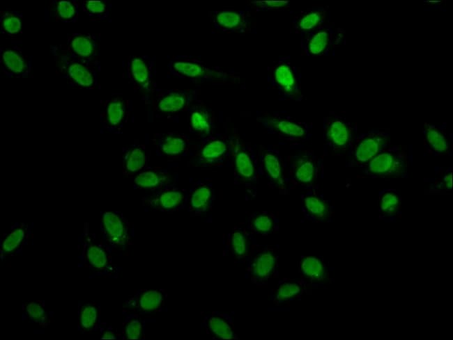 100UG HNRNP A1 ANTIBODY 100 ug