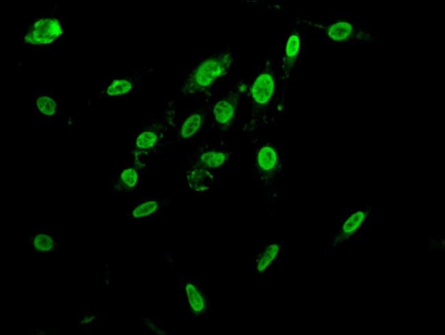 100UG HNRNP AB ANTIBODY 100 ug
