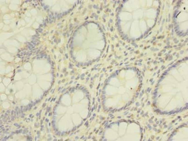 100UG HNRNP L ANTIBODY 100 ug