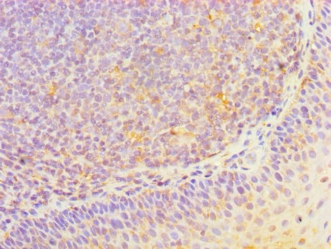 100UL HOXA1 ANTIBODY 100 ul