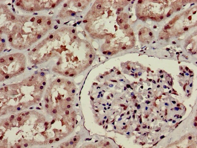 100UG HOXA6 ANTIBODY 100 ug