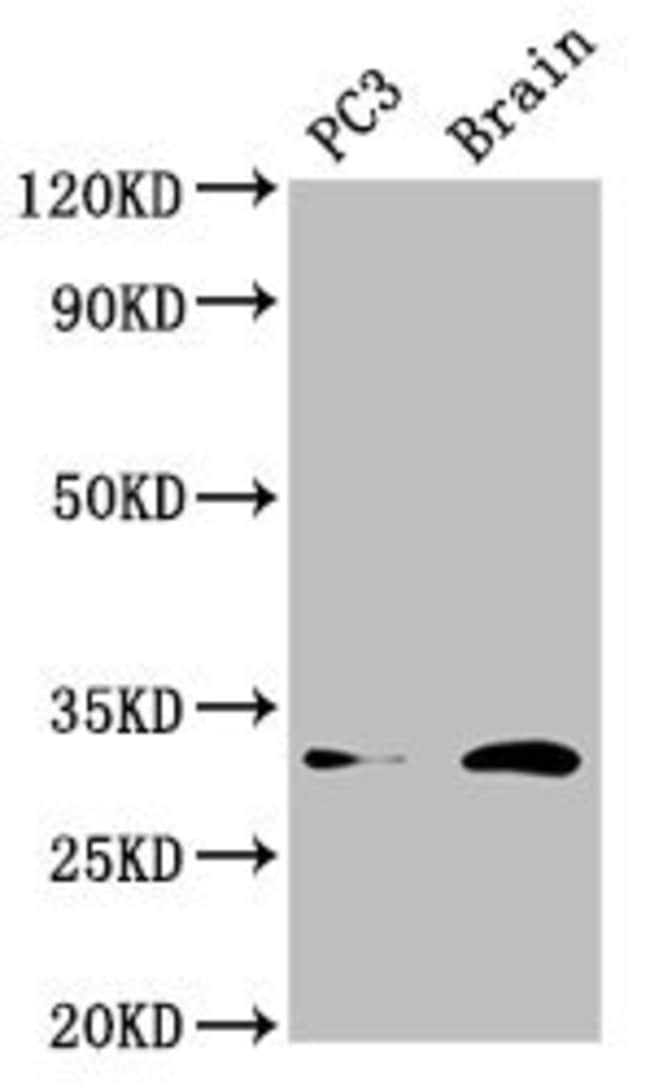 100UG HOXD8 ANTIBODY 100 ug