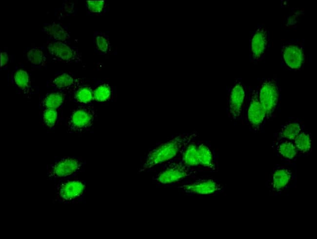 100UG HPD ANTIBODY 100 ug