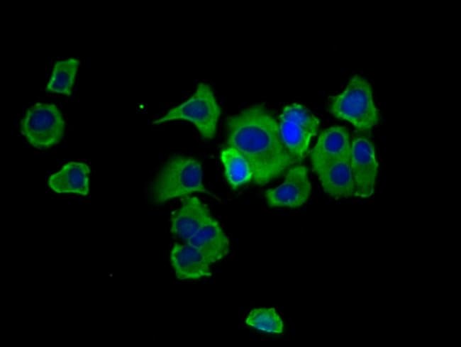 100UG HEPSIN ANTIBODY 100 ug